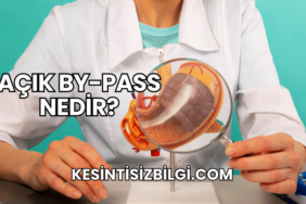 Açık By-Pass Nedir?