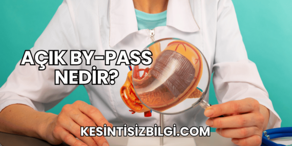 Açık By-Pass Nedir?