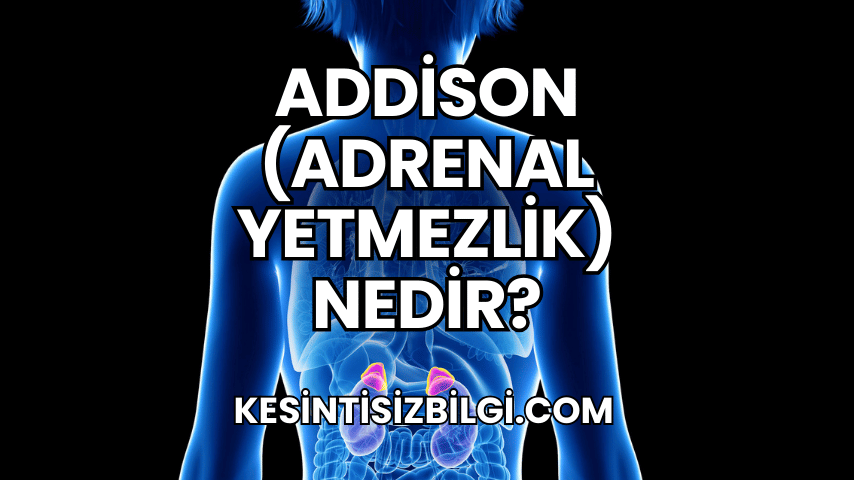 Addison (Adrenal Yetmezlik) Nedir?