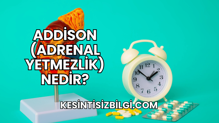 Addison (Adrenal Yetmezlik) Nedir?