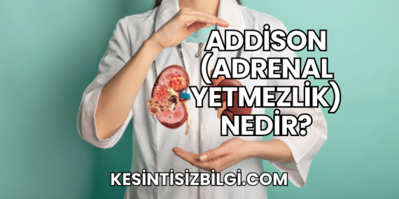 Addison (Adrenal Yetmezlik) Nedir?