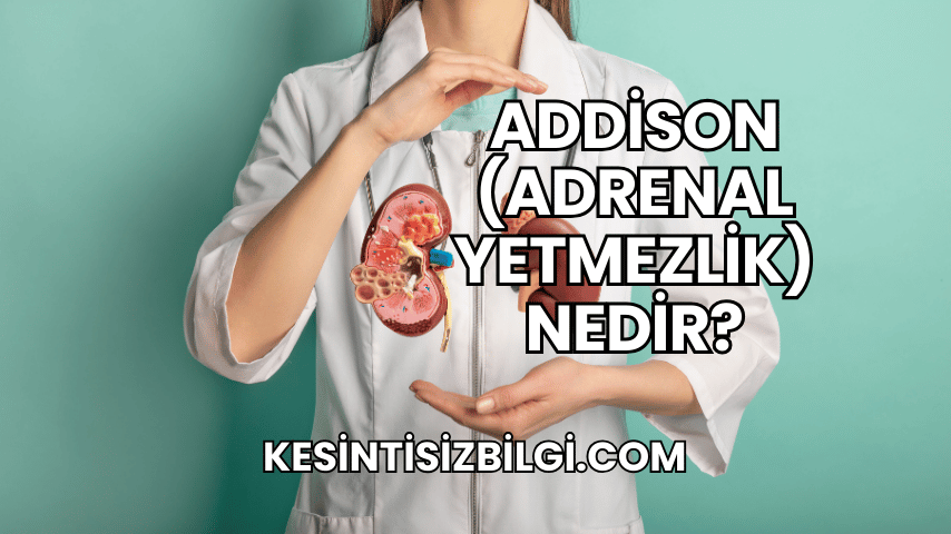 Addison (Adrenal Yetmezlik) Nedir?