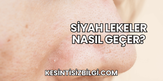 Siyah Lekeler Nasıl Geçer?