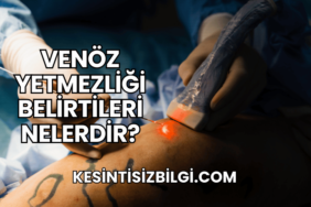 Venöz Yetmezliği Belirtileri Nelerdir?