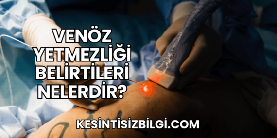 Venöz Yetmezliği Belirtileri Nelerdir?